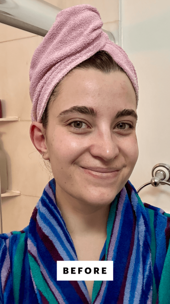 Felbin before applying the Anua PDRN Hyaluronic Acid 100 Moisturizing Cream